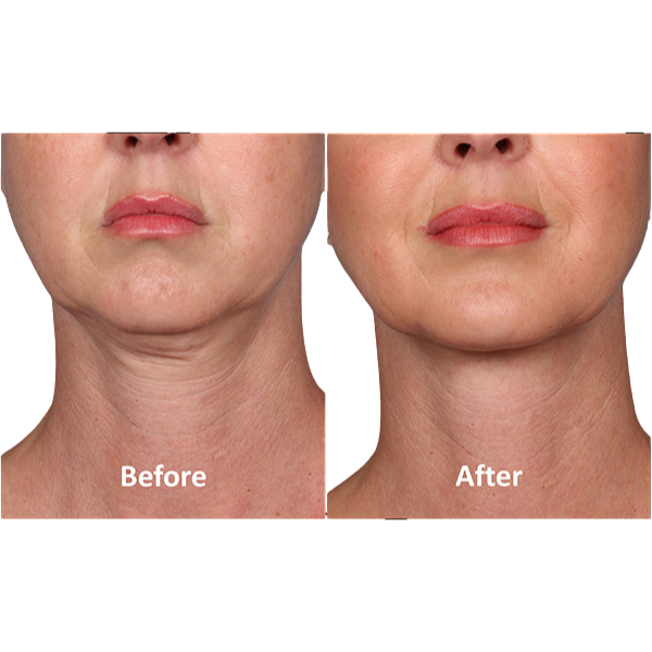 Elouria Tighten & Lift Neck Cream