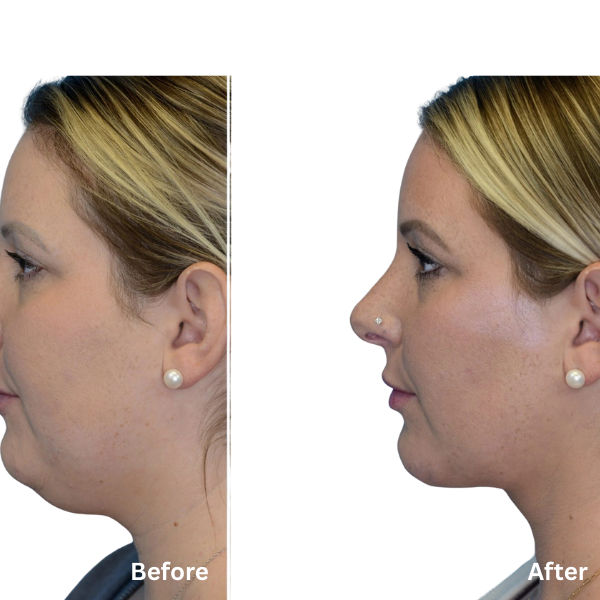 Elouria Tighten & Lift Neck Cream