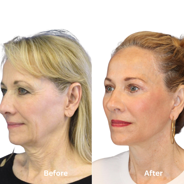 Elouria Tighten & Lift Neck Cream