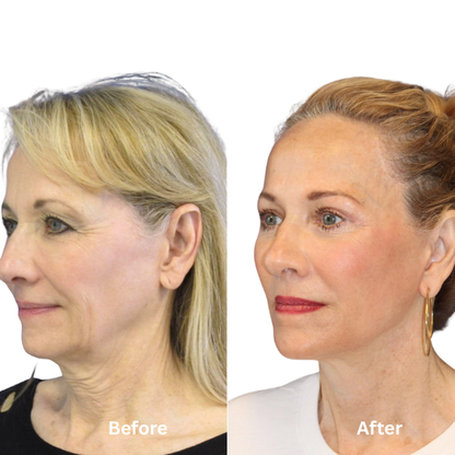 Elouria Tighten & Lift Neck Cream
