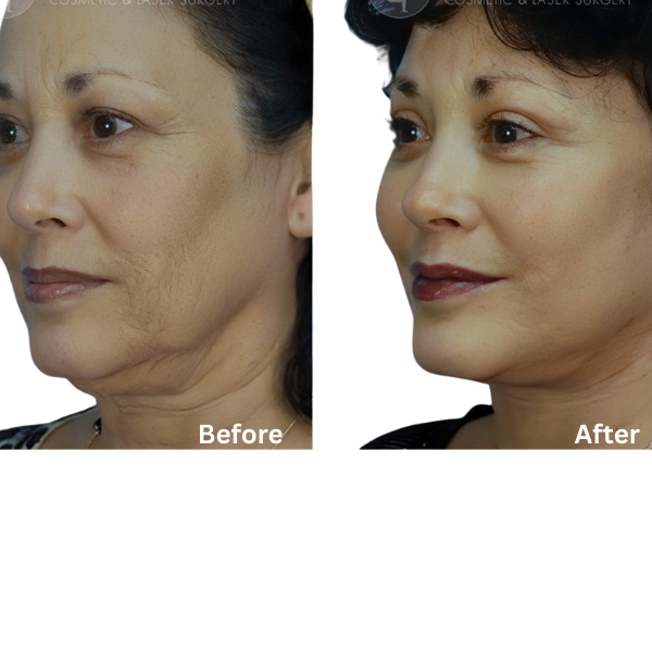 Elouria Tighten & Lift Neck Cream